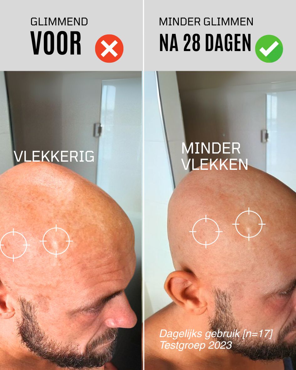 After shave crème met 95% Uv-bescherming