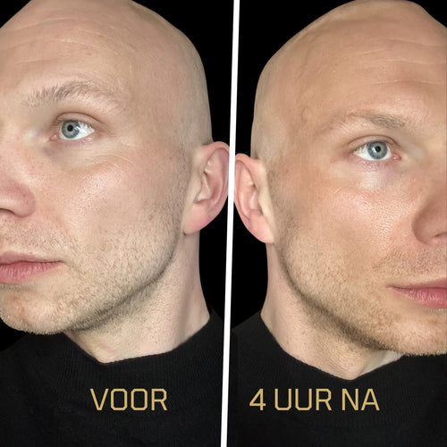 BRONZE LAYER met ANTI-PALE PROTOCOL voor een aantrekkelijke bruine gloed