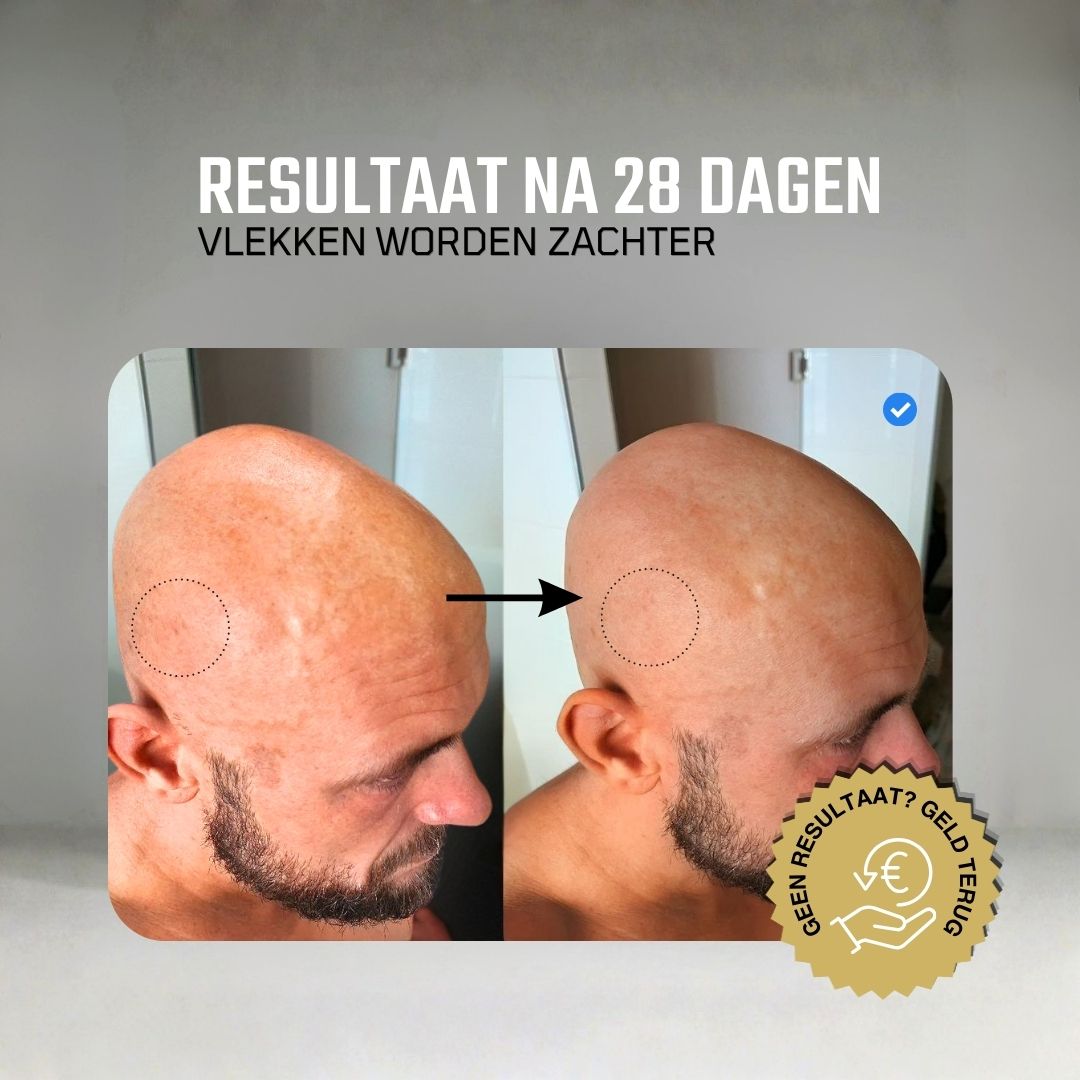 Kaal hoofd verzorgen - Startpakket - After shave + SPF + Reiniger