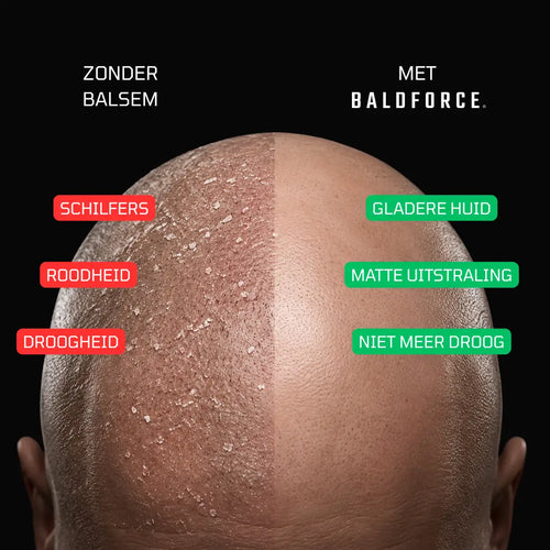 24H ANTI-SHINE (nacht)balsem zonder SPF